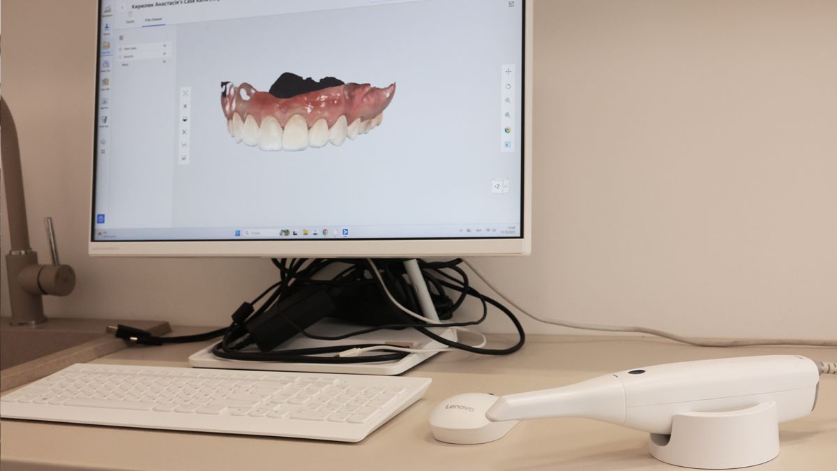 3D-модель щелепи пацієнта на моніторі поруч з інтраоральним сканером у SM Dental